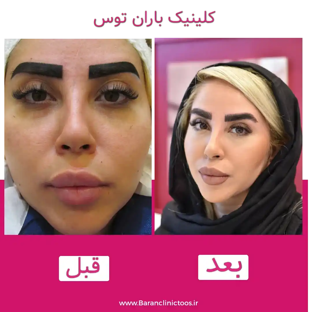 قبل و بعد کاشت ابرو روی تتو